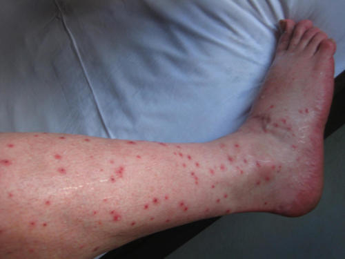 I was bitten by a swarm of small black flies as I attempted to clean the Arapaima head. A lesson learned.